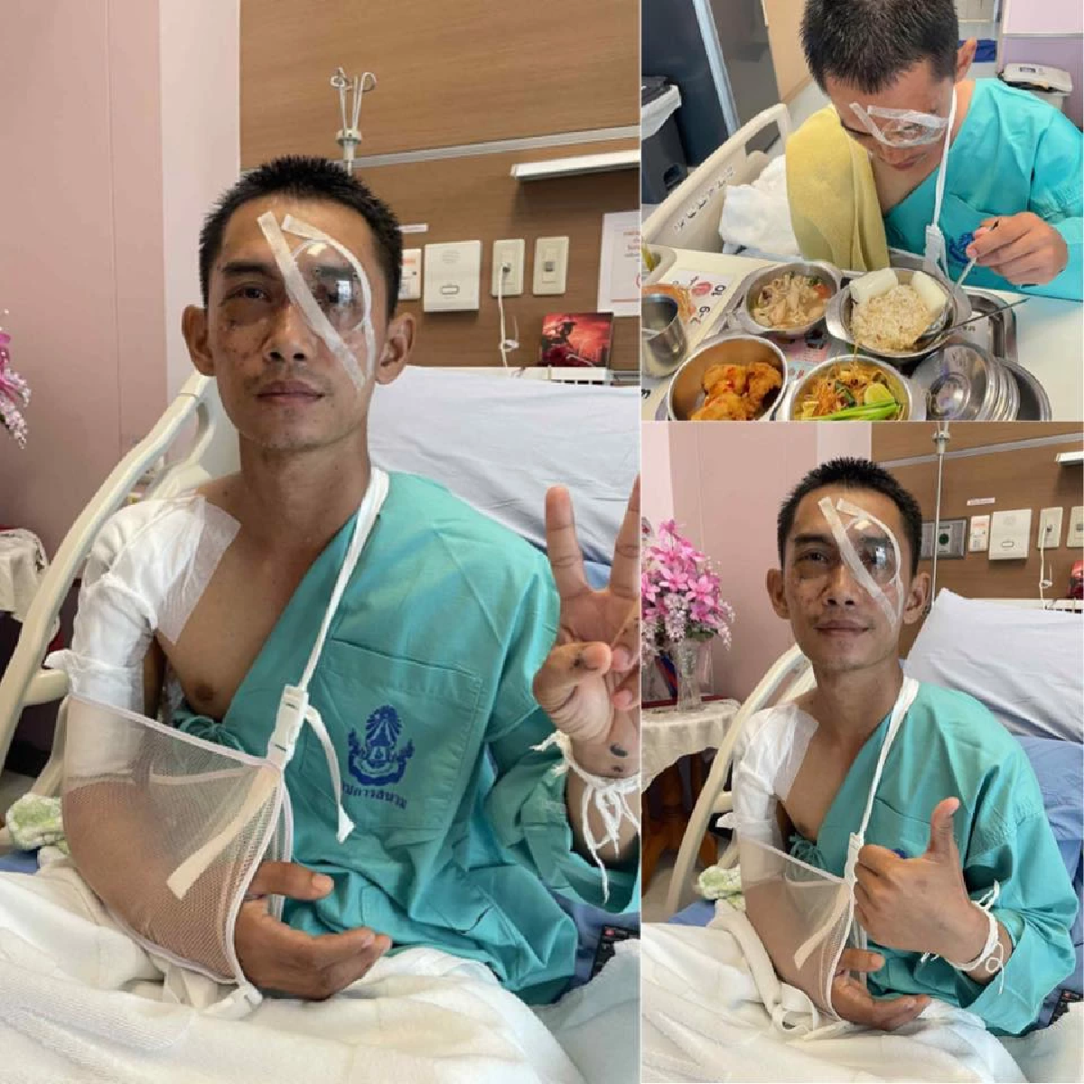 ส่งกำลังใจ \"สิบเอกสุทธิชัย\" ผ่าตัดตารอบ 3 หลังถูกกระสุนระเบิดปืน ค.