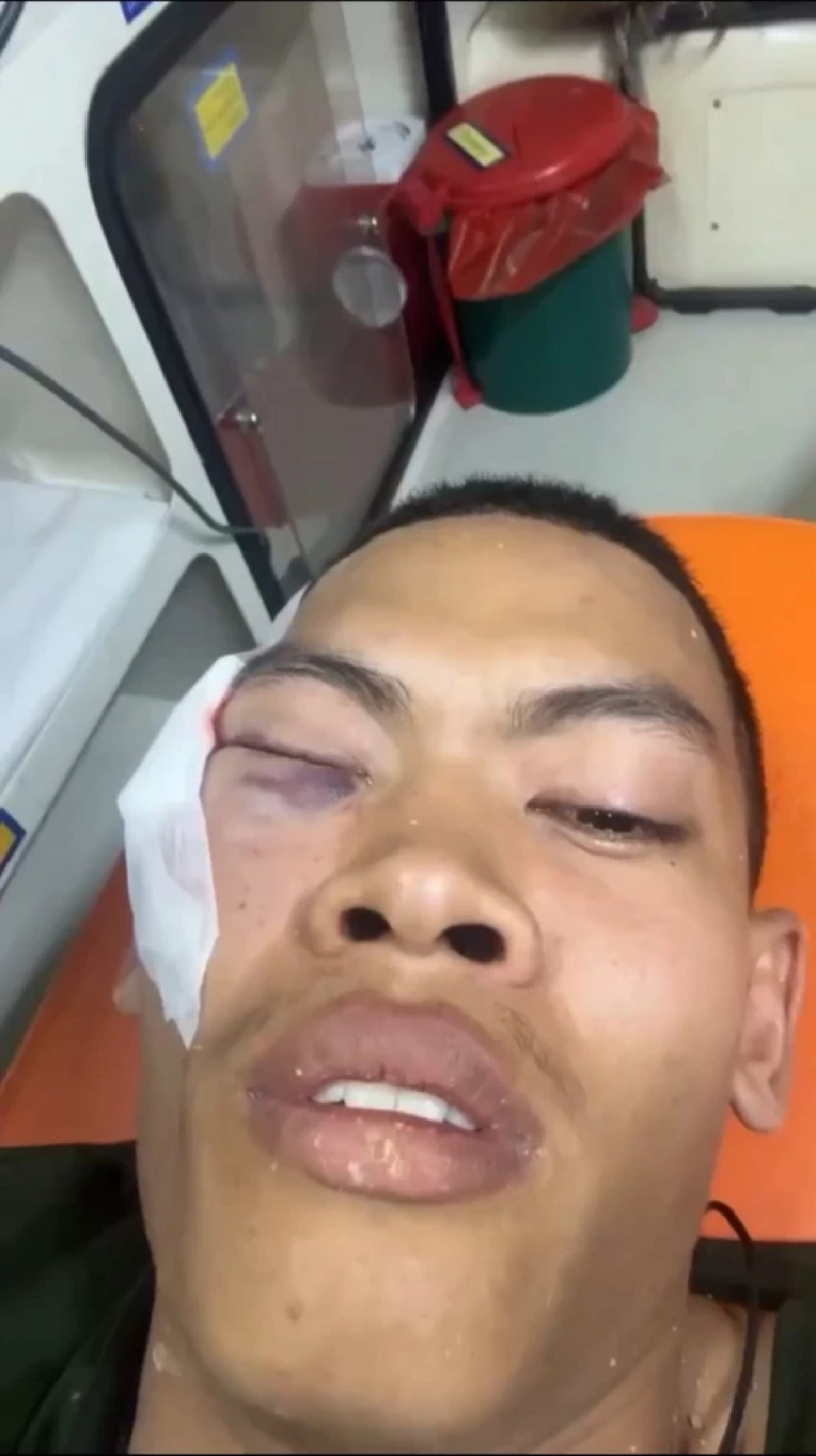 เปิดใจ พลทหารตะวัน ในวันที่สูญเสียตา 1 ข้าง หลังถูกสะเก็ดระเบิด