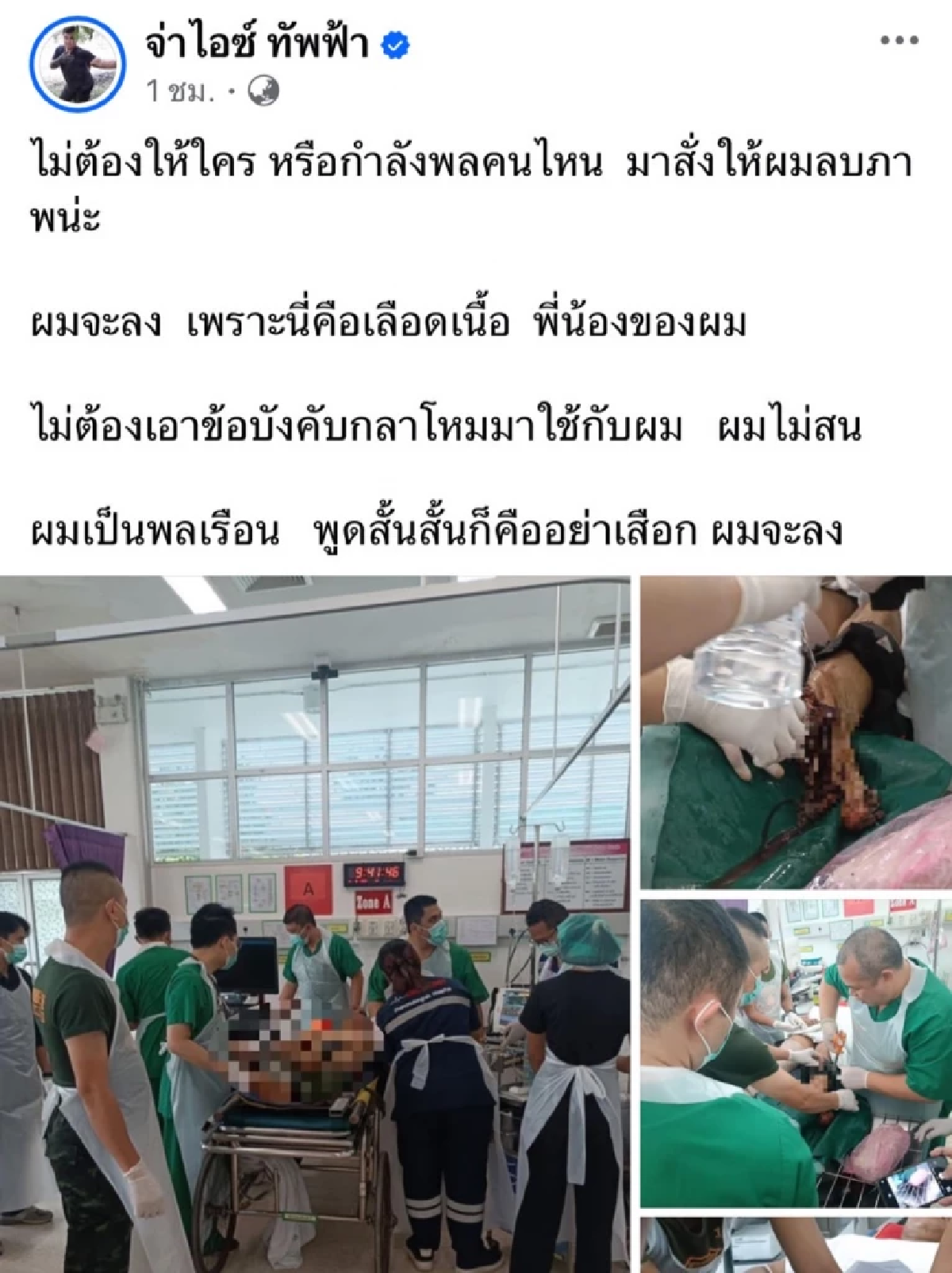เสียงจากเพื่อนแนวหน้า \"พวกผมไม่ไหวแล้ว\" หลังทหารไทยเหยียบระเบิดขาขาด