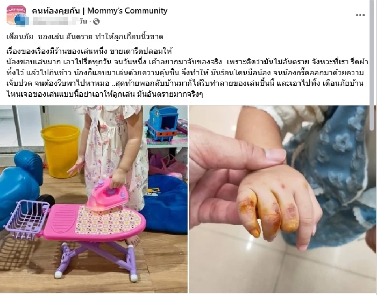 แม่โพสต์เตือน ลูกเล่น "เตารีดของเล่น" แต่ดันอยากจับของจริง ทำเกือบนิ้วขาด