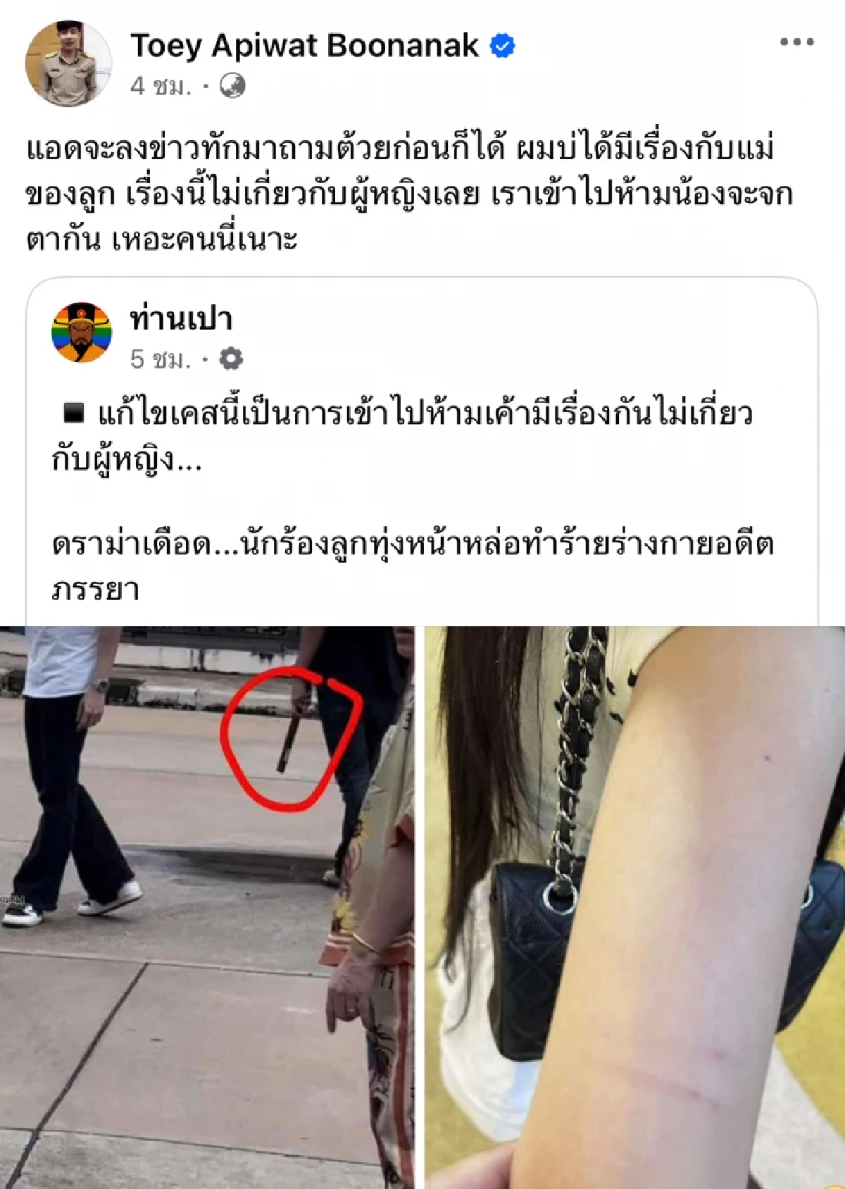 \"ครูเต้ย\" เดือด! ข่าวทำร้ายอดีตภรรยา ด้าน \"ขนม ศศิกานต์\" ย้ำไม่ได้โดน