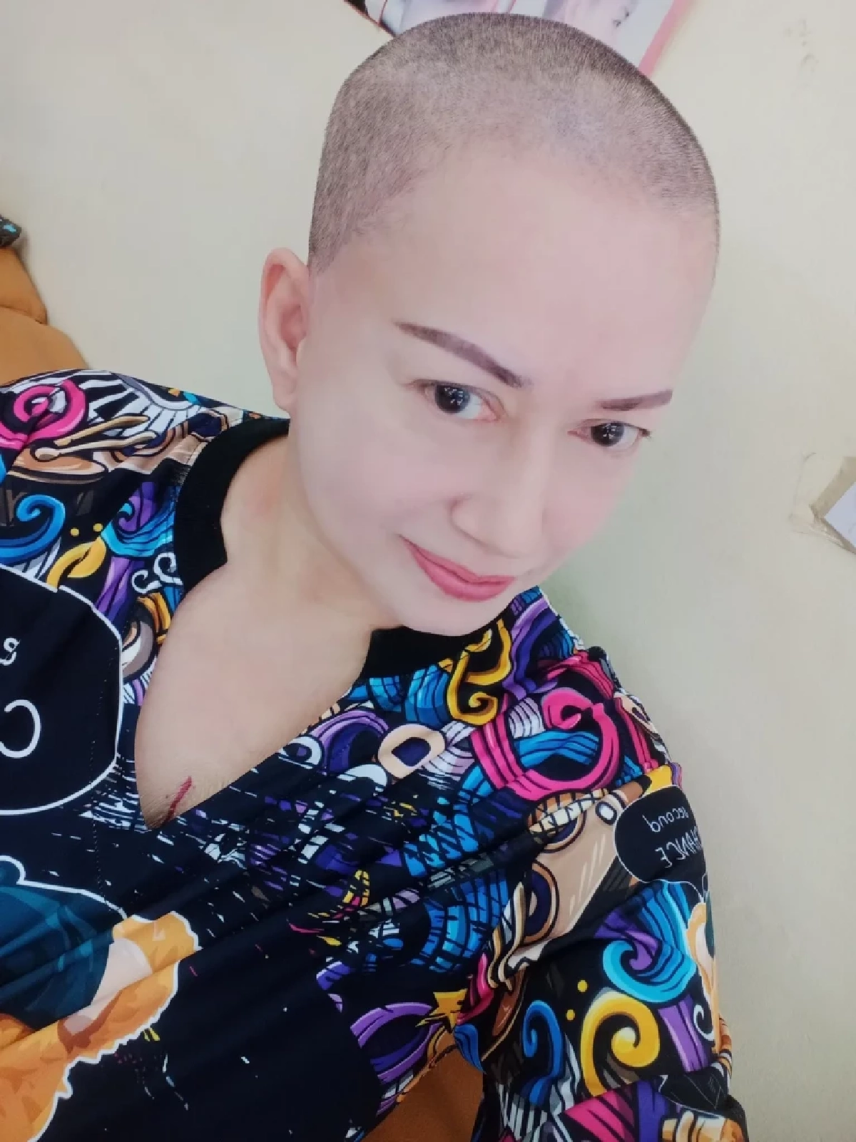 "แหม่ม อลิษา" โกนผมสู้มะเร็งปอดระยะ 3 ลามเข้า 4 แฟนเคียงข้างให้กำลังใจไม่ห่าง