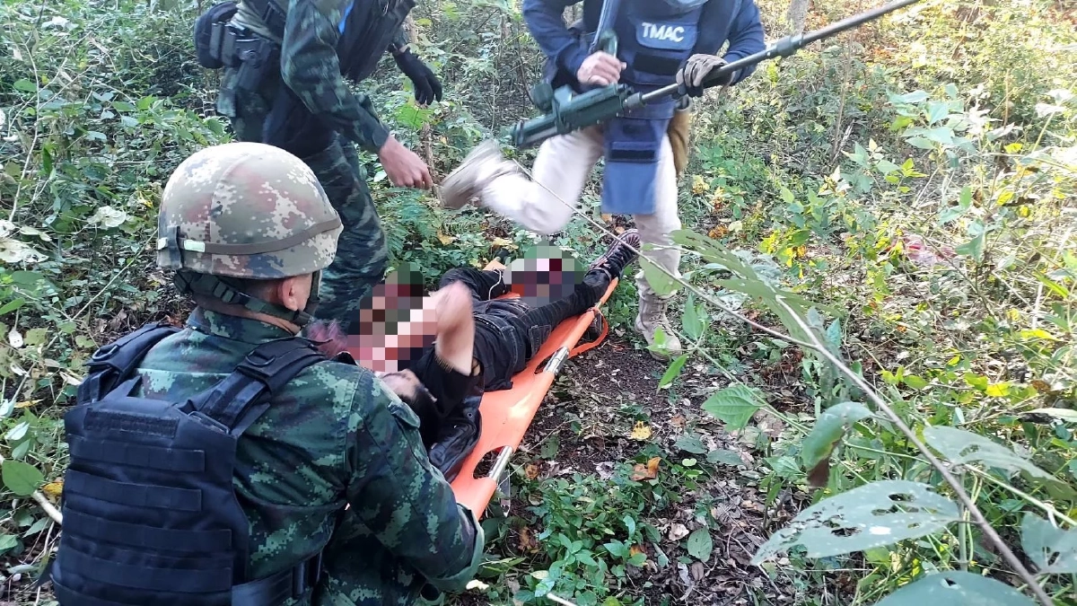 ชายชาวจีน เหยียบกับระเบิดระหว่างลักลอบข้ามแดนได้รับบาดเจ็บ