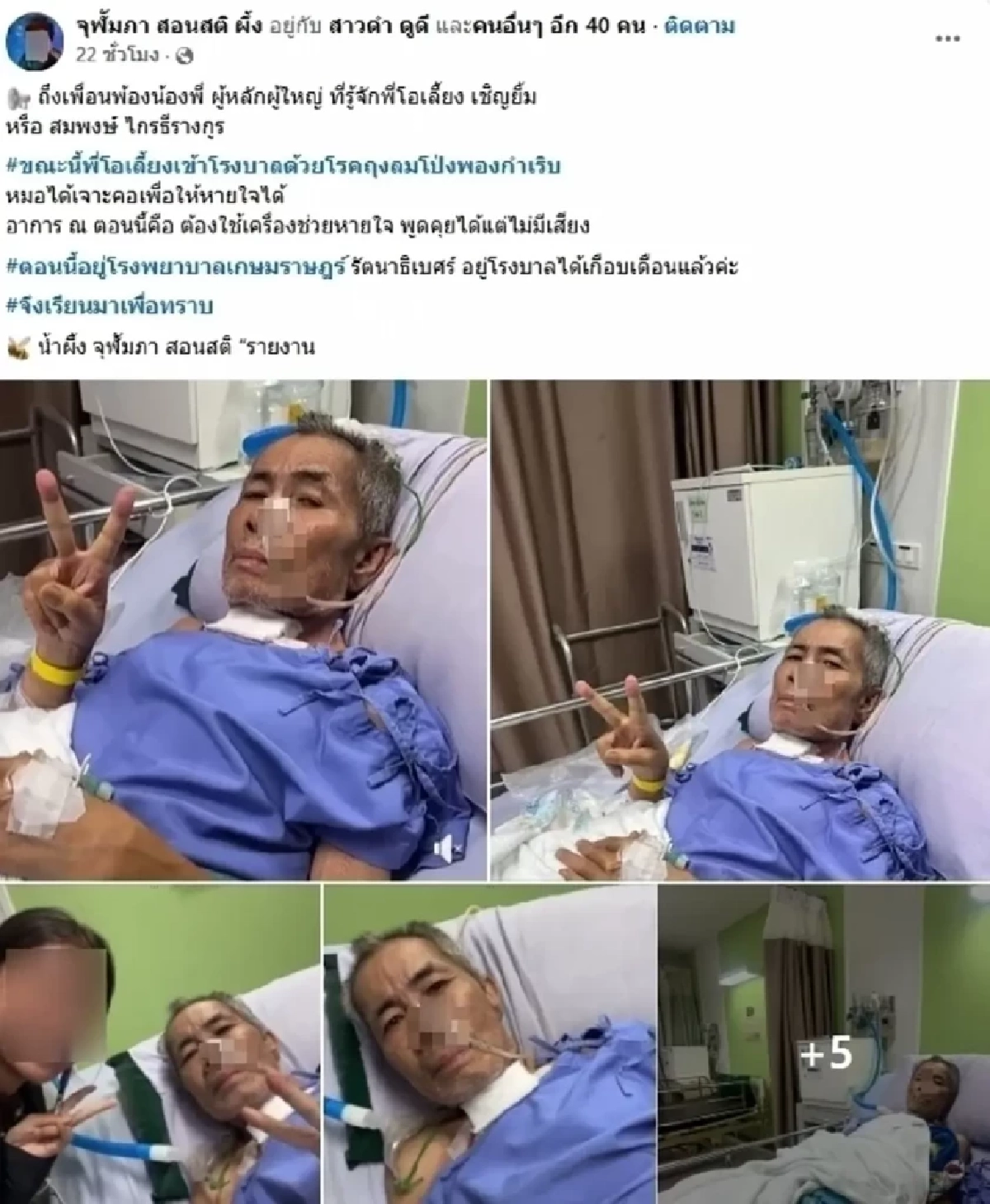 แทบจำไม่ได้! ตลกดังป่วยหนัก ถูกเจาะคอ-ไร้เสียงพูด นอนโรงพยาบาลเกือบเดือน