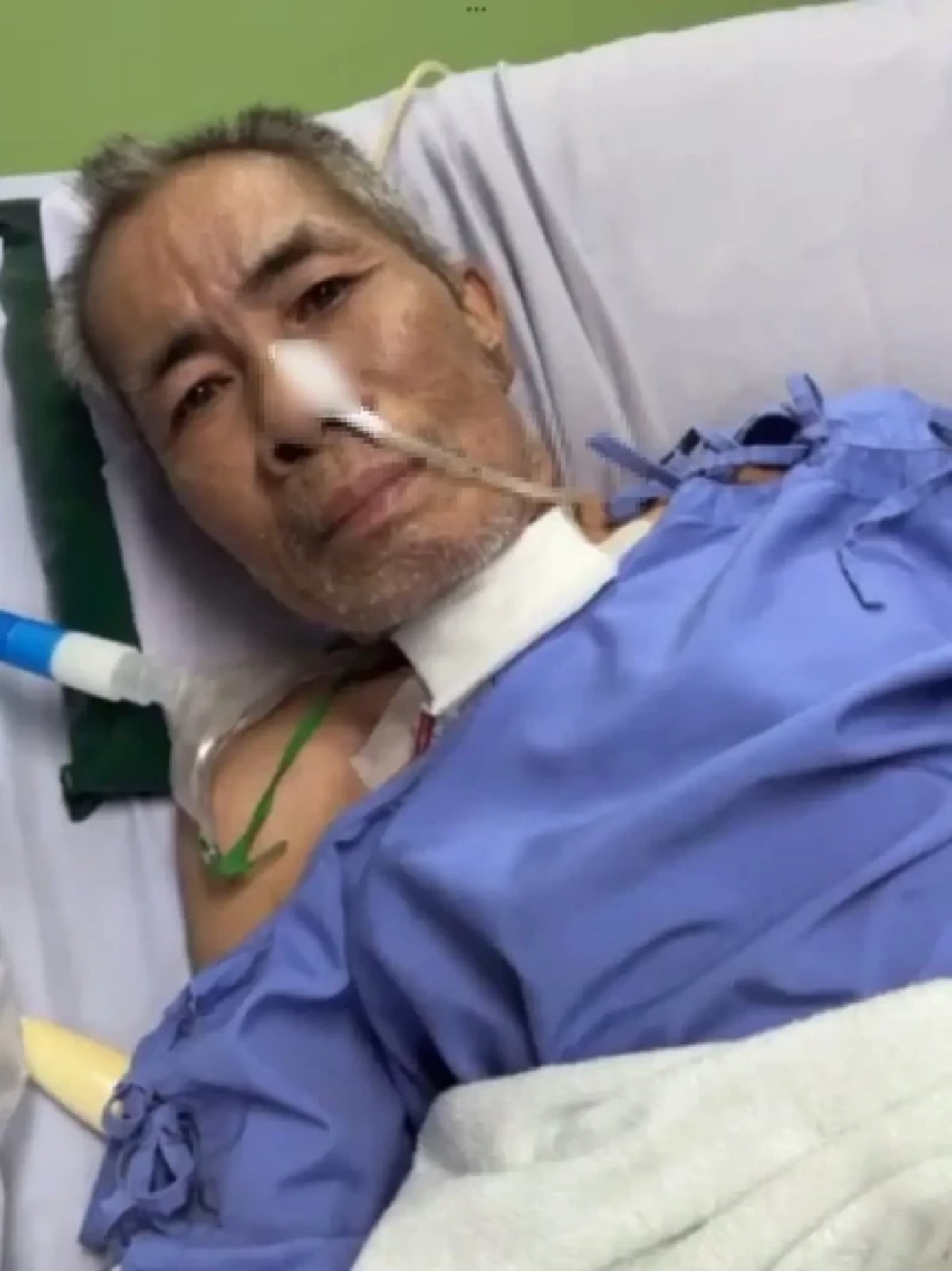 แทบจำไม่ได้! ตลกดังป่วยหนัก ถูกเจาะคอ-ไร้เสียงพูด นอนโรงพยาบาลเกือบเดือน