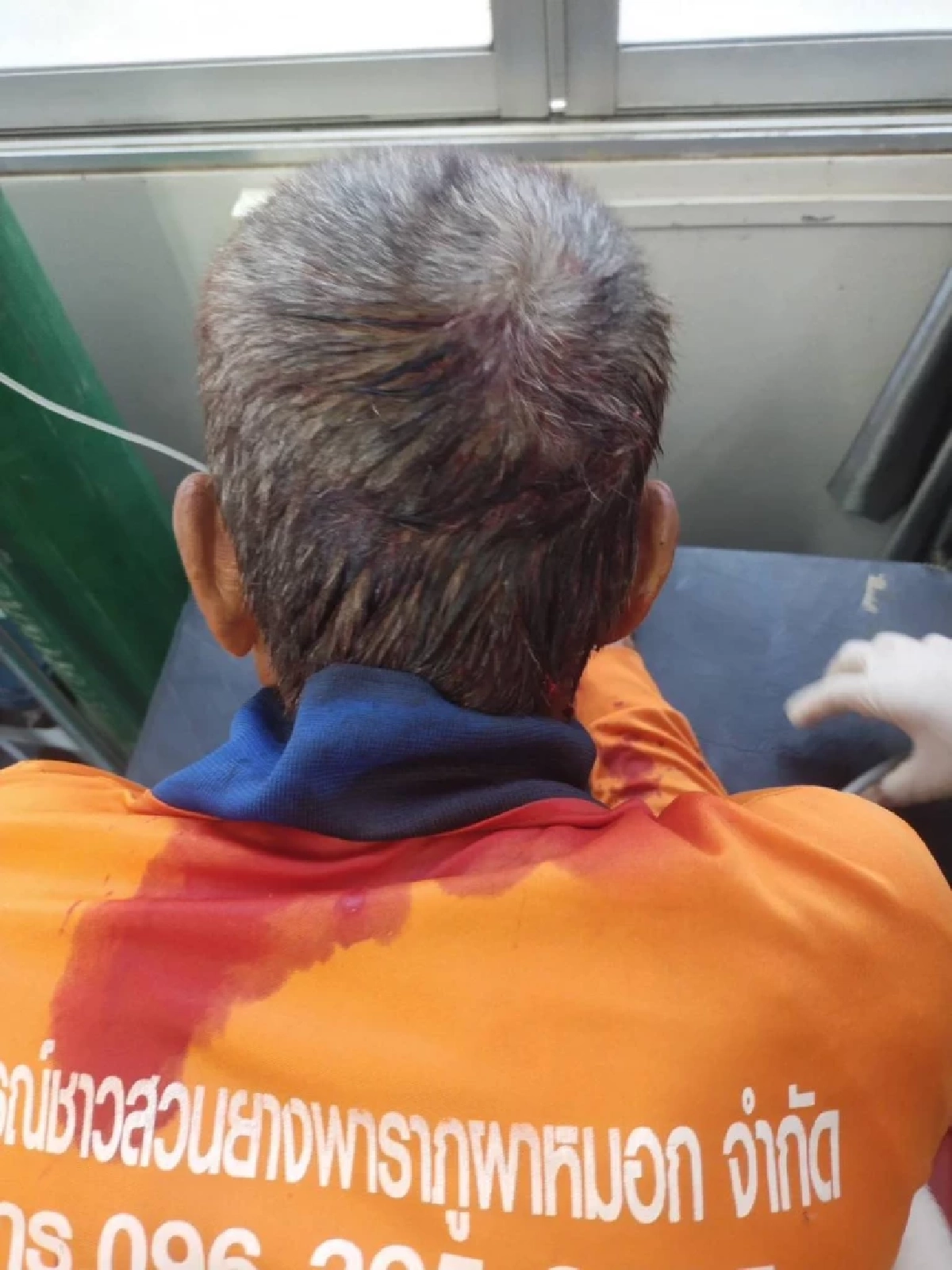 เปิดอาการบาดเจ็บ 4 ราย ถูกระเบิด BM-21 ถล่มในพื้นที่ชุมชน