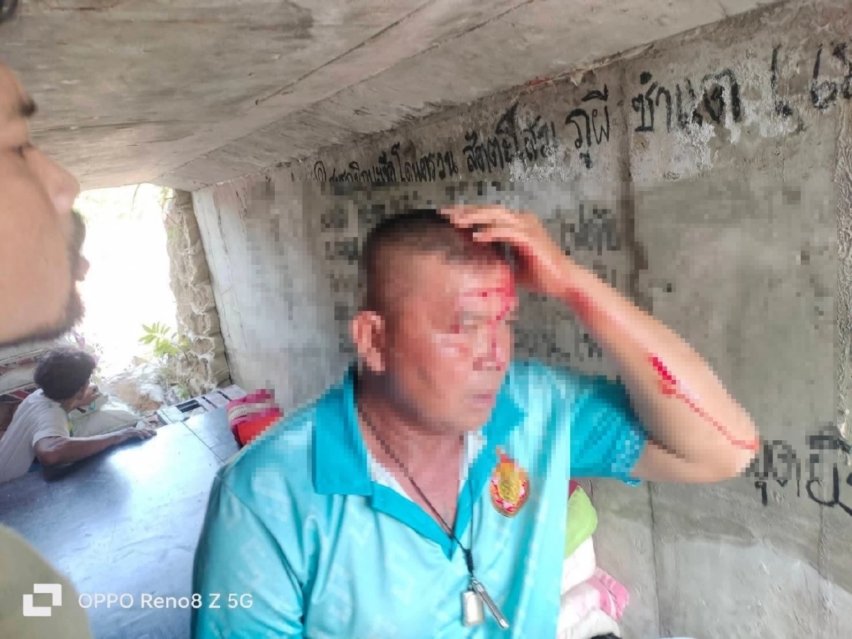 เขมรยิงระเบิด BM-21 ถล่มบ้านพัง ชาวบ้านเจ็บหวิดแขนขาด