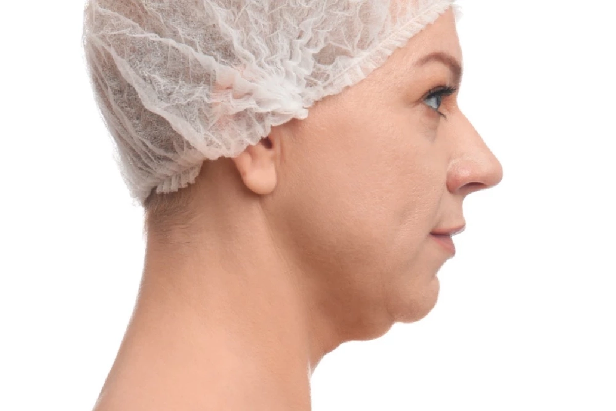 เหนียงคืออะไร? ทำไมหลายคนถึงมีเหนียงแม้น้ำหนักไม่เยอะ