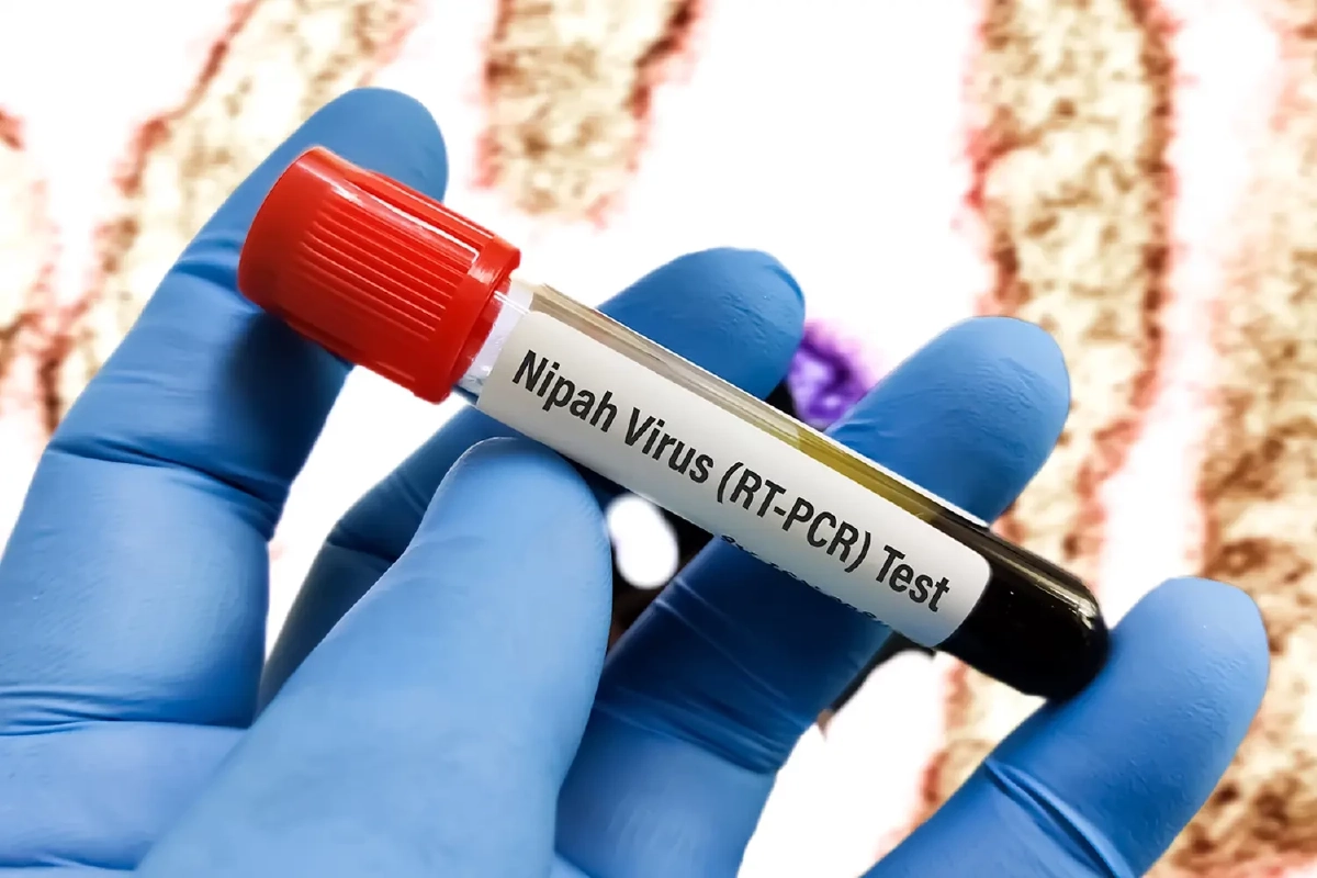 จีนพบยา "VV116" ต้านโควิดมีฤทธิ์ปราบ "ไวรัสนิปาห์" เร่งผลักดันเป็นยาหลัก