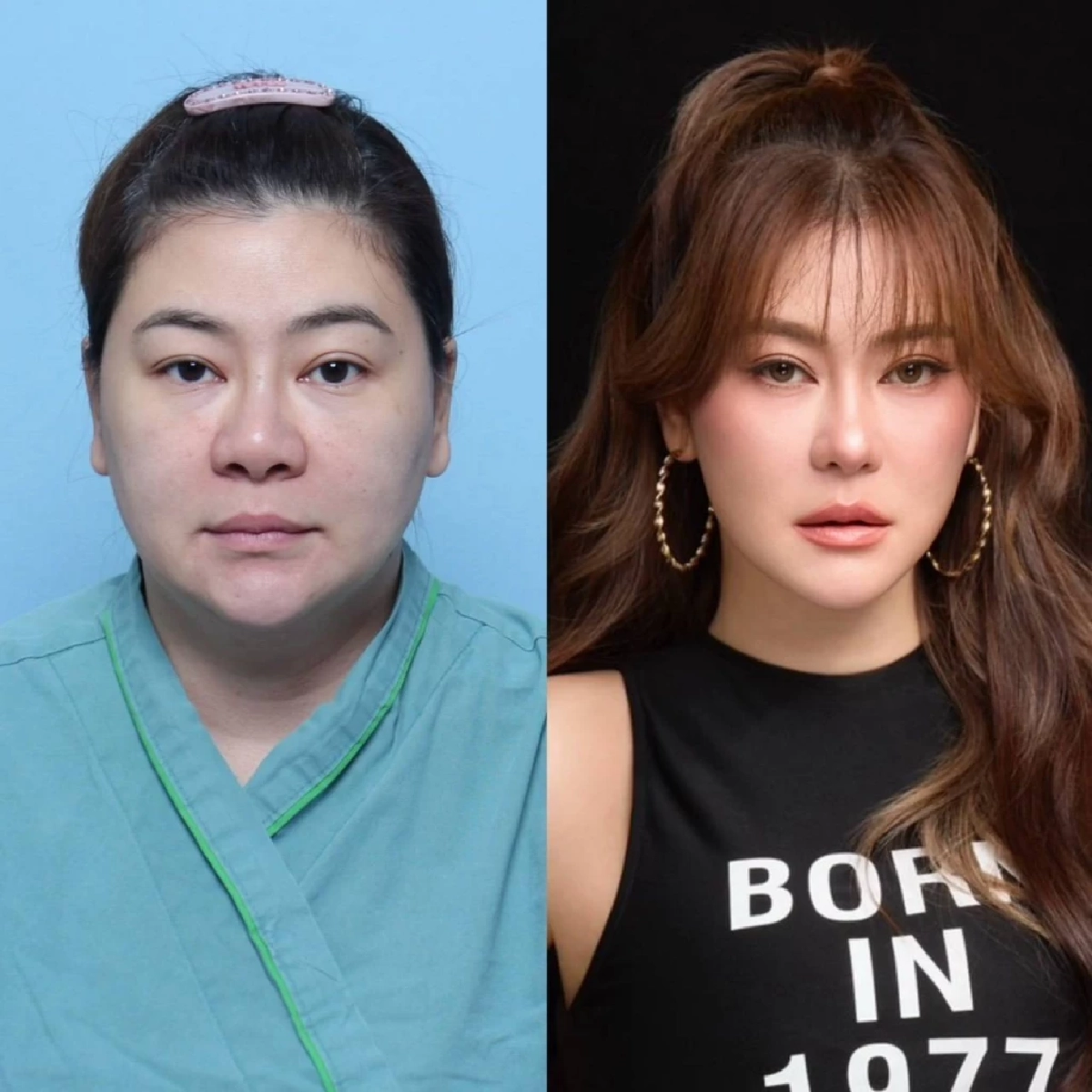 "โอ๋ ภัคจีรา" เปิดเบื้องหลัง ทำศัลยกรรม 6 จุด สวยย้อนวัย 10 ปี