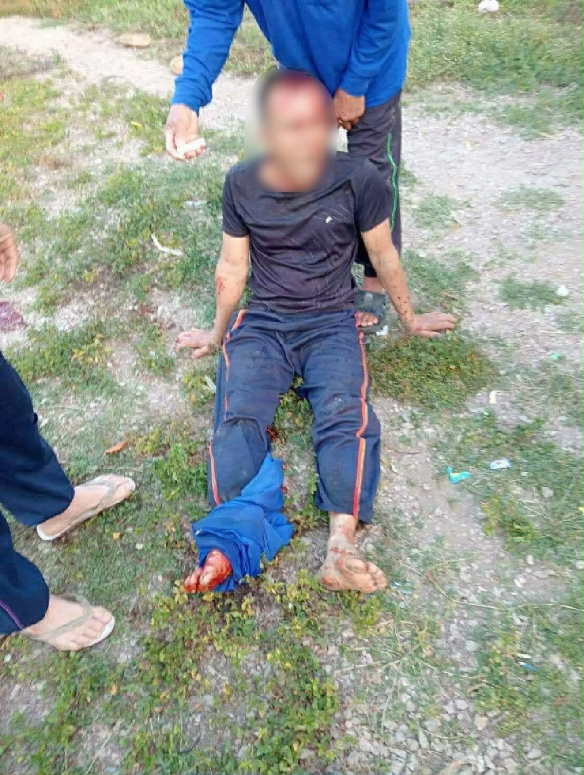 'ลูกทรพี' ทาสยานรก คลั่งควงมีดไล่จ้วง พ่อพิการ เจ็บสาหัส