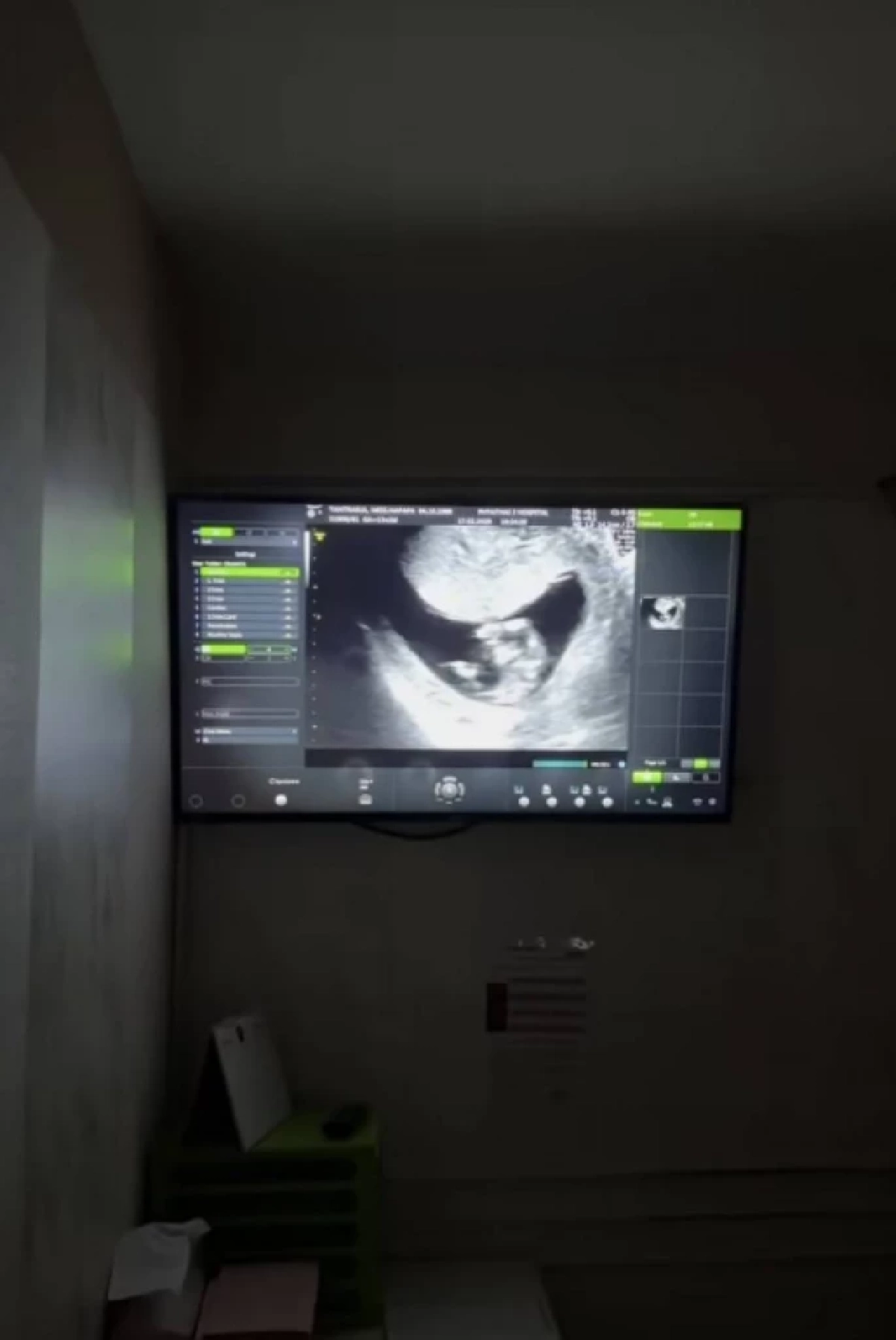 ท้องแล้วจ้า! "แพท ณปภา" ขึ้นแท่นคุณแม่ลูกสองเต็มตัว ตั้งท้อง 3 เดือน