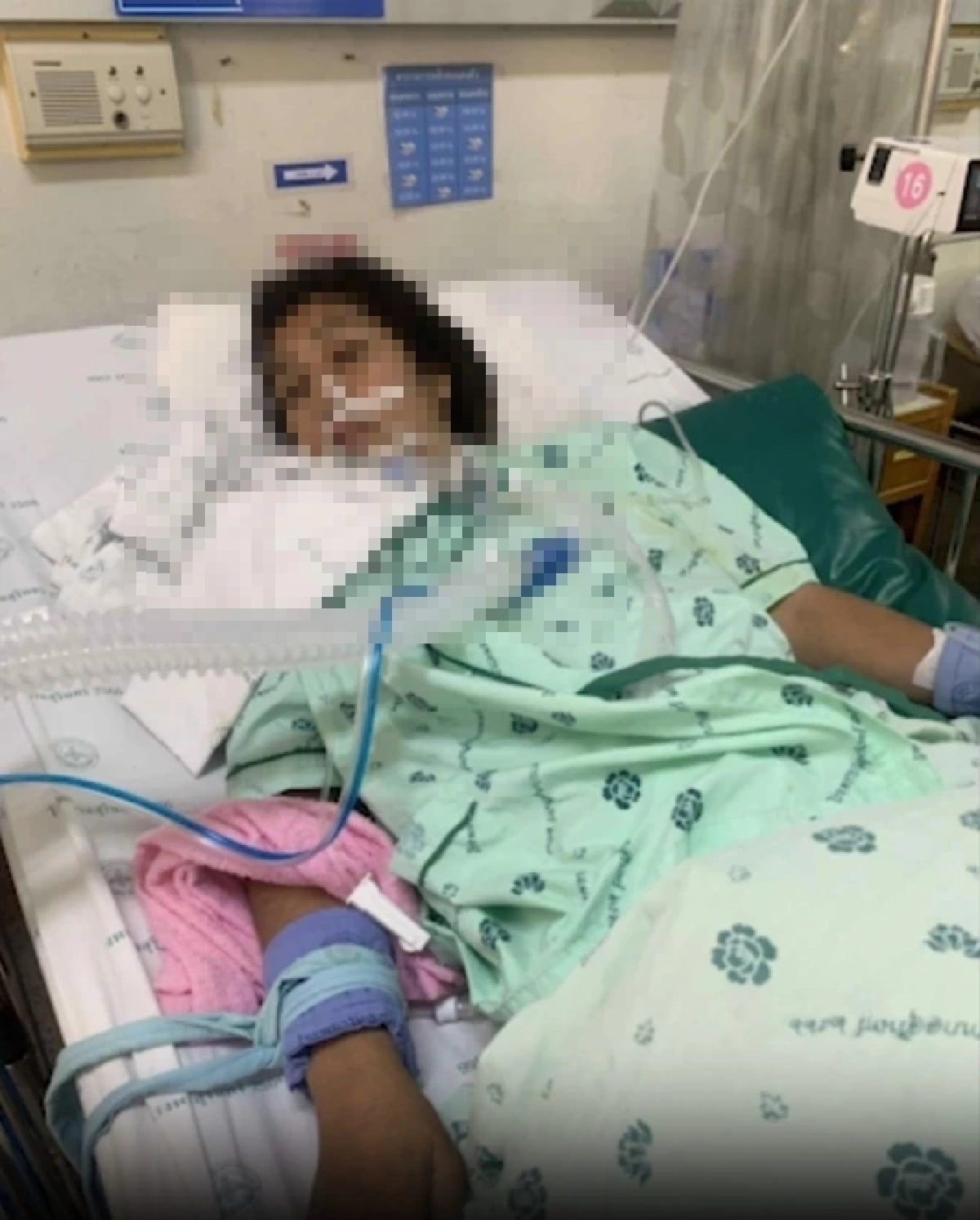 นาทีเฉียดตุย สาวเปิบยำไข่แมงดา 2 คำ ช็อกหมดสติ-ชีพจรหยุดเต้น เข้า ICU