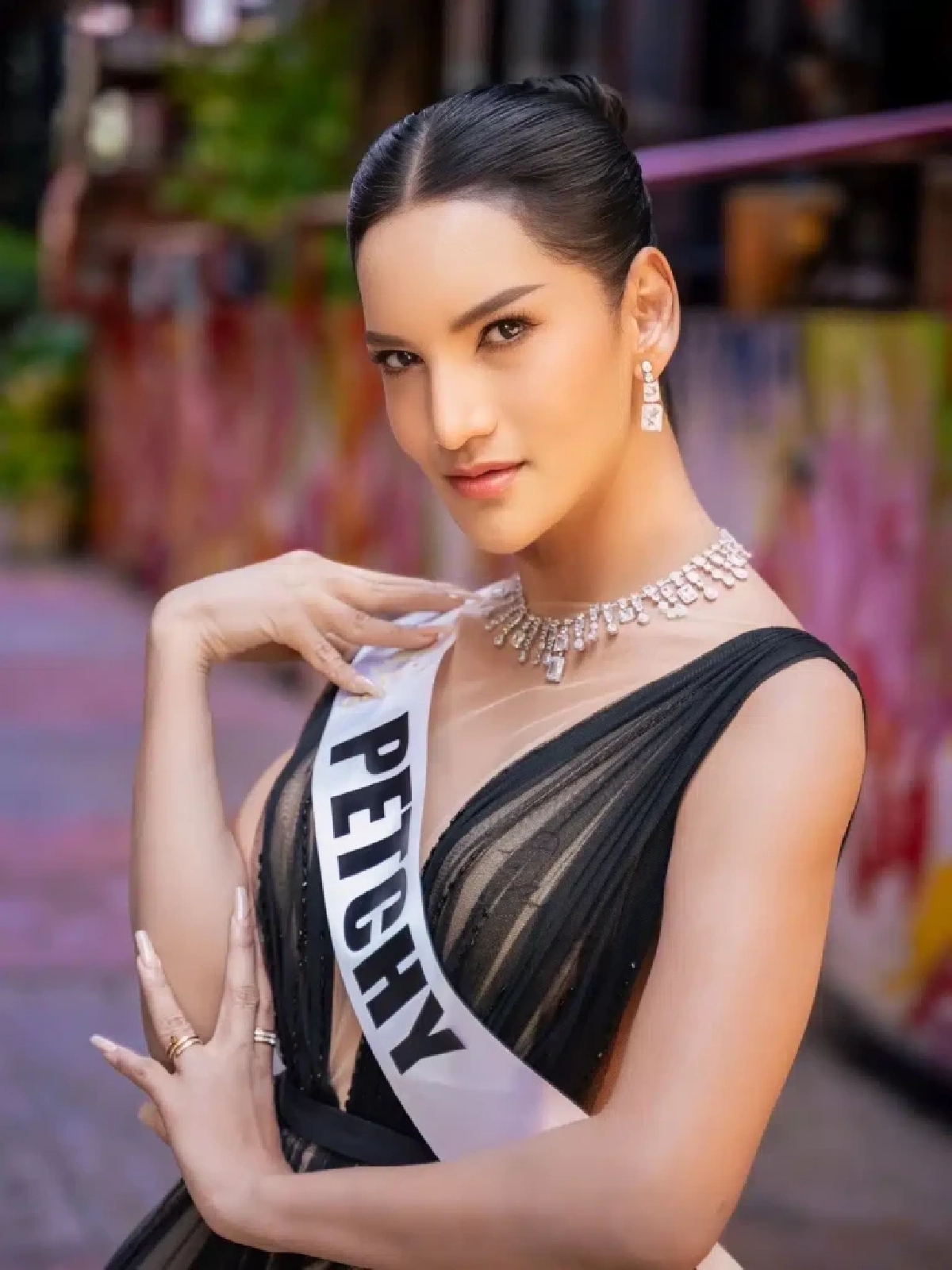 รู้แล้ว! “เพชร ปากปลาร้า” ป่วยเป็นโรคอะไร  ยัน! ยังไม่ตาx  ต้องฉีดยา 66 เข็ม