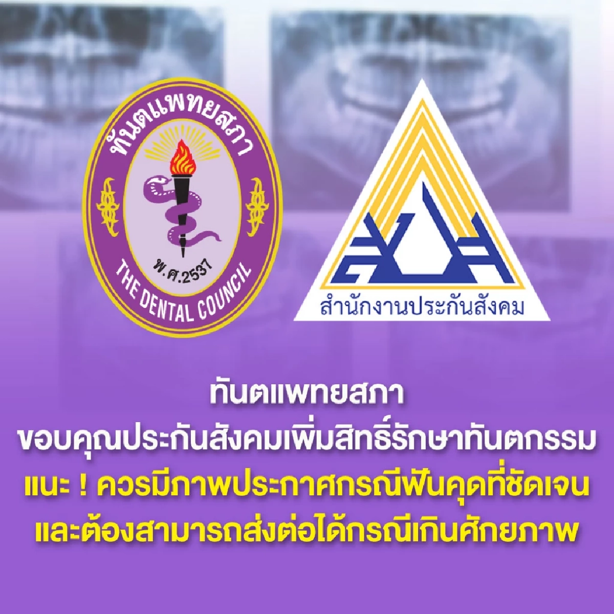 ทันตแพทยสภา อธิบายสิทธิประโยชน์ "ผ่าฟันคุด" ในคลินิก สำหรับผู้ประกันตน