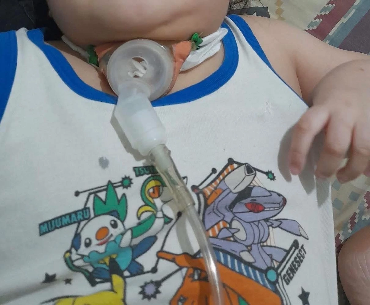 ค่าฝุ่น PM เชียงใหม่ ทำพิษ! คนxายผ่อนส่งมากขึ้น โดยเฉพาะเด็กๆ