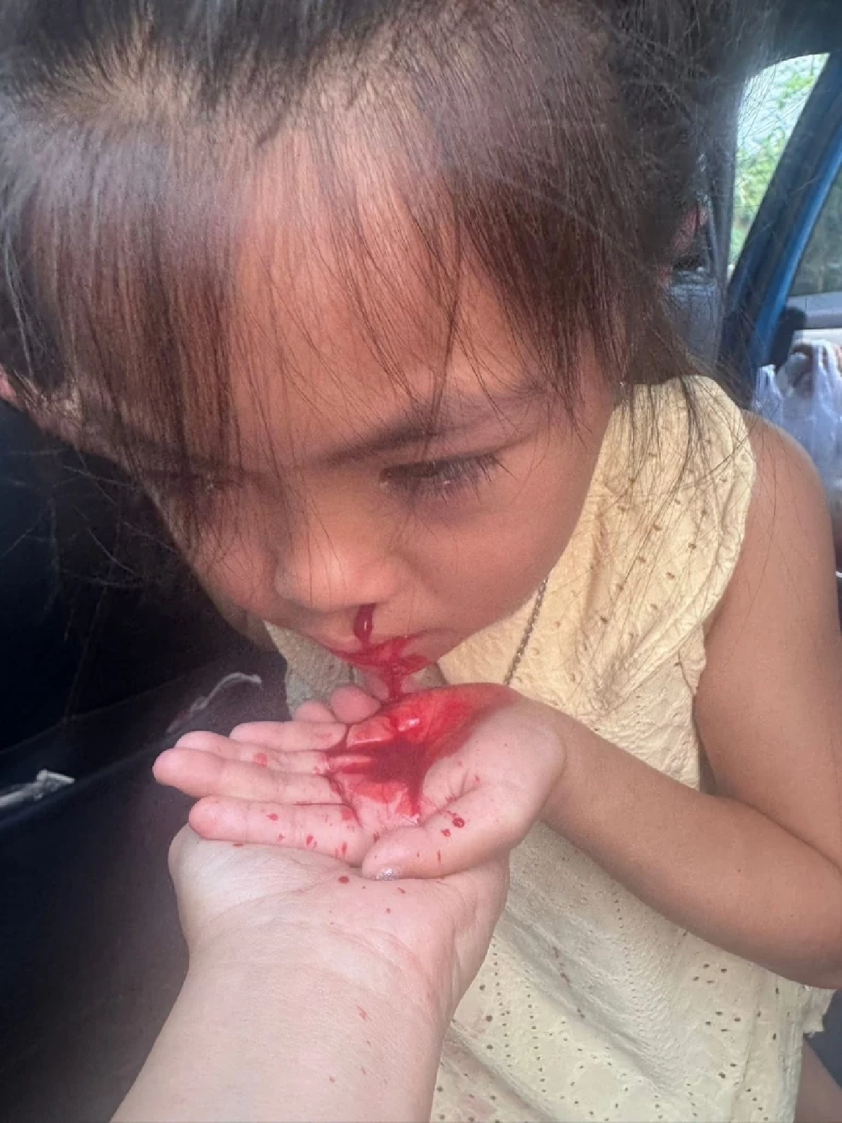 ค่าฝุ่น PM เชียงใหม่ ทำพิษ! คนxายผ่อนส่งมากขึ้น โดยเฉพาะเด็กๆ