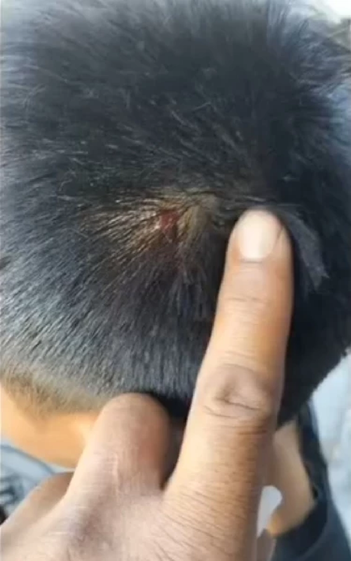 เกินไปไหม! ครูสอนพิเศษ เอามือถือฟาดเด็ก 7 ขวบหัวแตก ขอจ่าย 500 จบเรื่อง