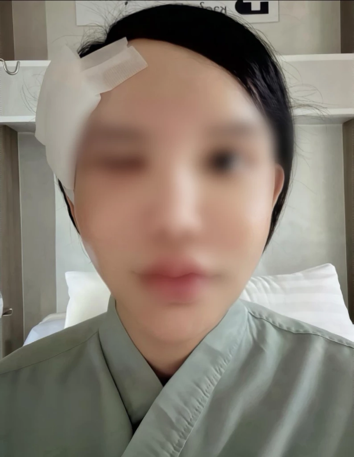 สาวโพสต์ติดเชื้อพยาธิลามไปที่ขอบตาหลังกิน "กุ้งแช่น้ำปลา"