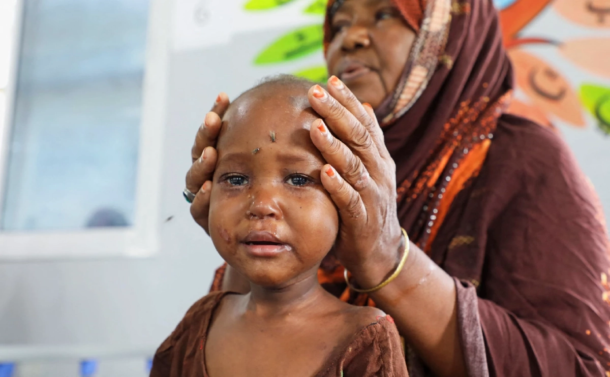 เด็กโซมาเลีย นับแสนคน ใกล้อดxาย เซ่นพิษวิกฤตช่องแคบฮอร์มุซ