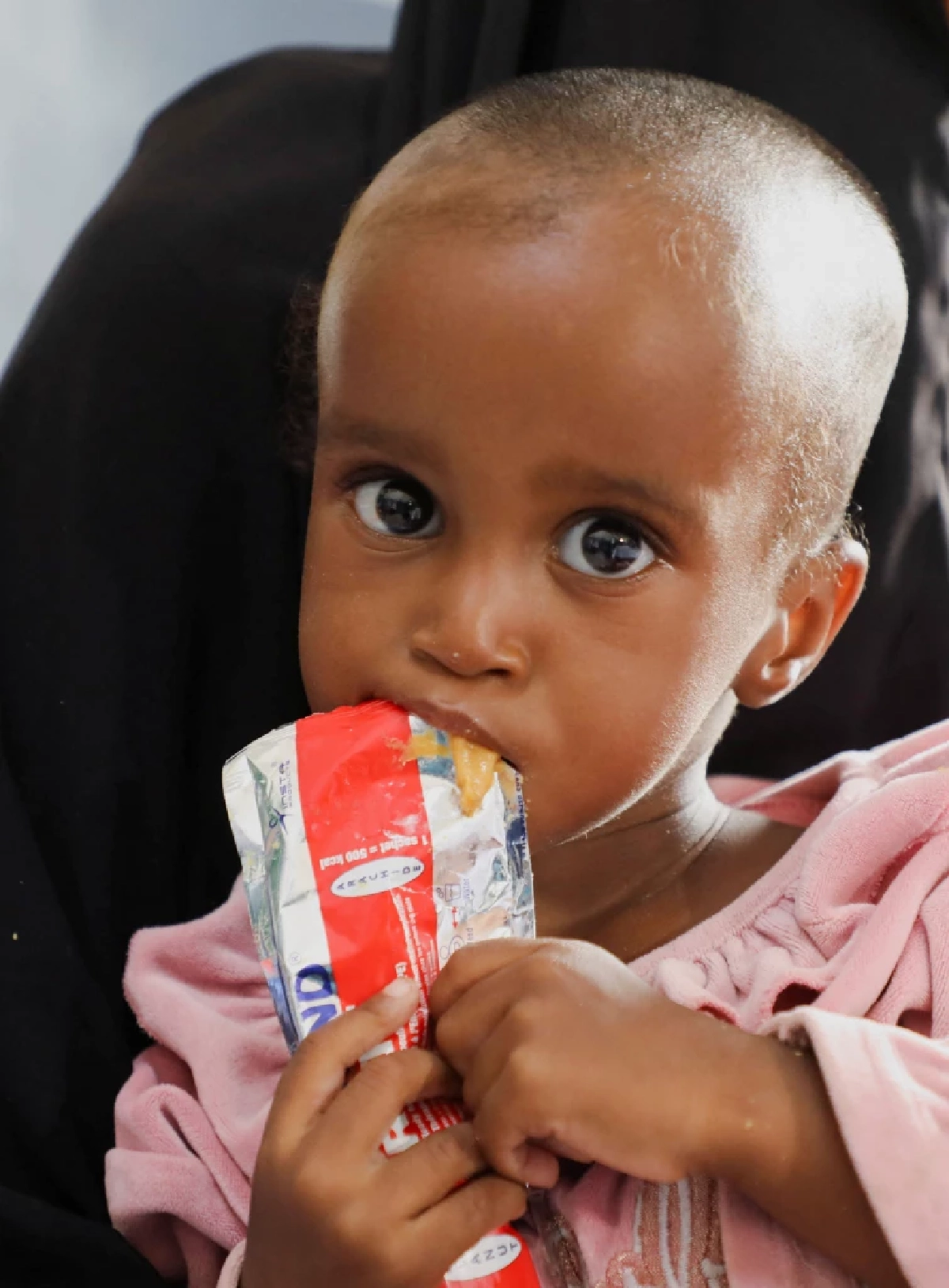 เด็กโซมาเลีย นับแสนคน ใกล้อดxาย เซ่นพิษวิกฤตช่องแคบฮอร์มุซ