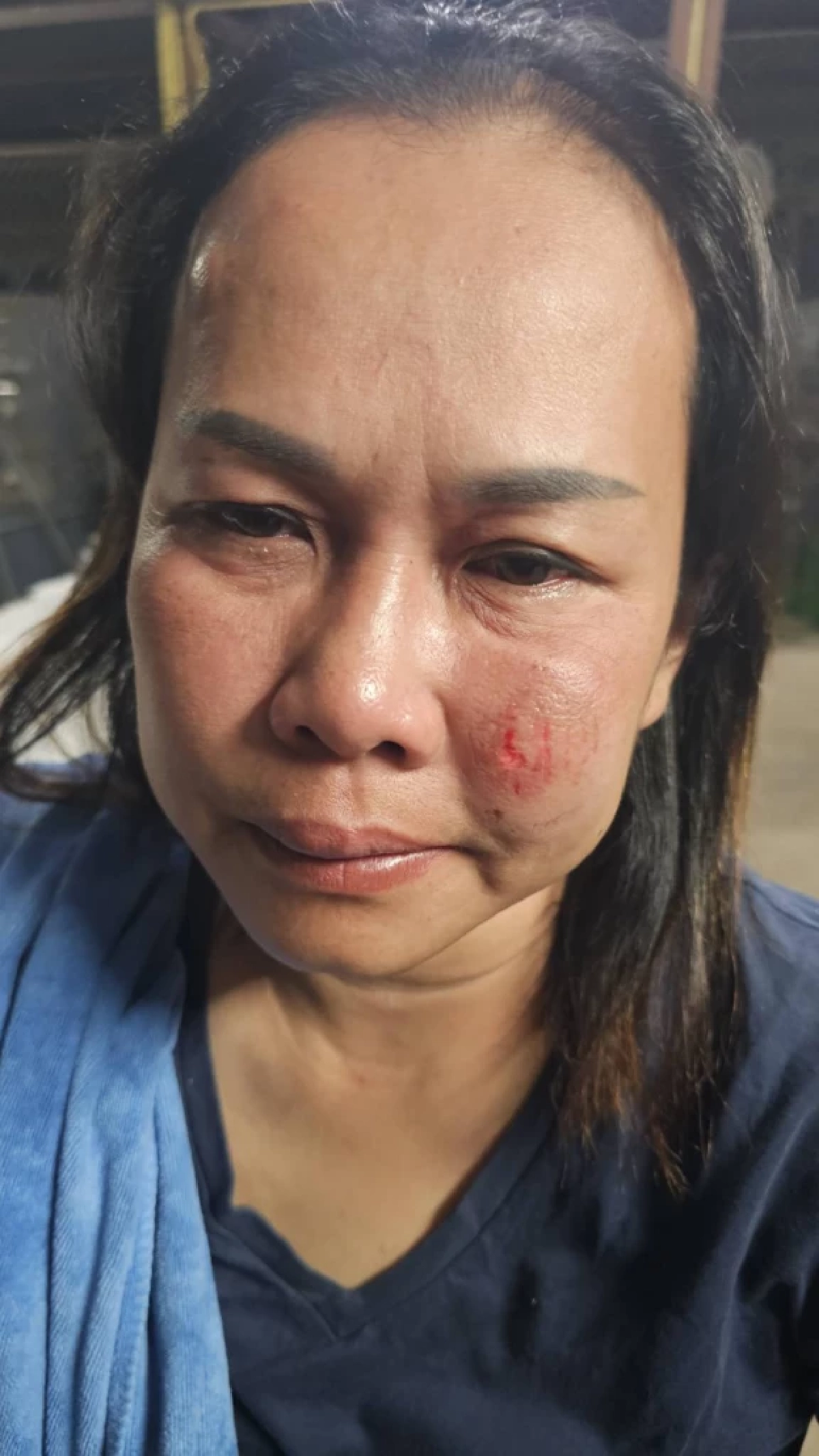 หนีxายหวุดหวิด! สาวใหญ่พิมาย  ถูกอดีตสามีกระทืบ-ตามหวง แม้เลิกไปนานนับปี