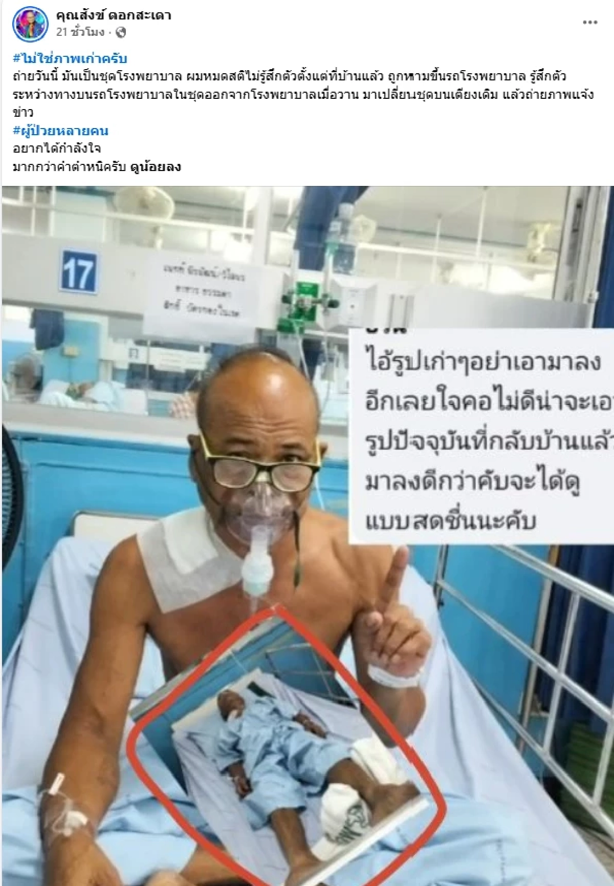ส่งใจช่วย "สังข์ ดอกสะเดา" อาการทรุดหนักเข้า ICU ต้องใส่ท่อช่วยหายใจ