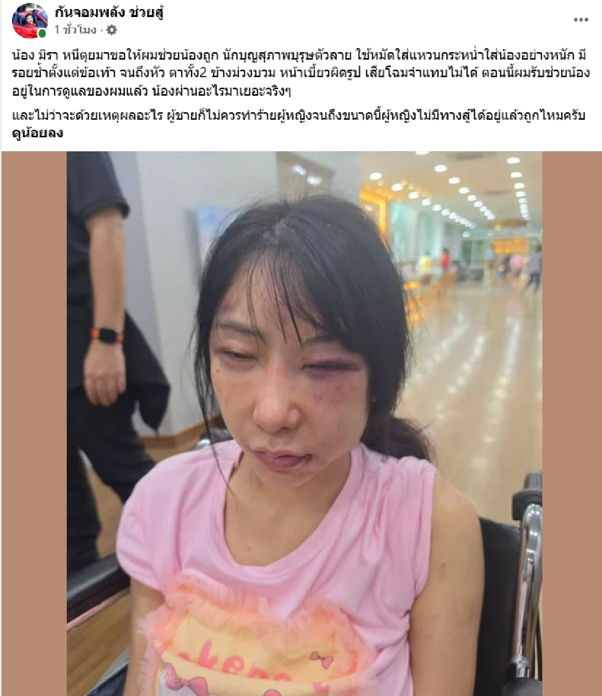 ‘กัน จอมพลัง’ ออกโรงกางปีกป้อง ‘น้องมิรา’ ถูกซ้อมน่วม โดนรัวหมัดยับจนเสียโฉม!