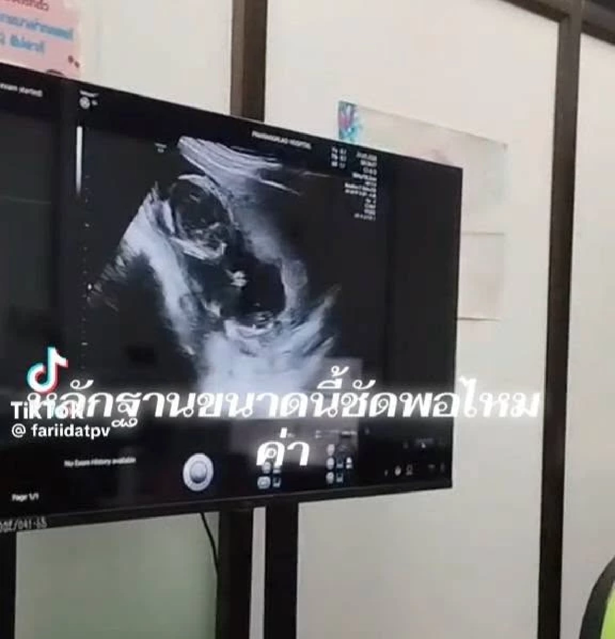 สรุปดราม่า! สาวอัดคลิปแฉอ้างเป็นคนคุย "นักร้องหนุ่ม" ทำท้องไม่รับ