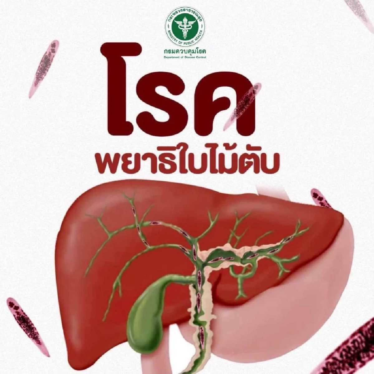 รู้จักโรค ‘พยาธิใบไม้ตับ’ ตัวการร้ายมะเร็งท่อน้ำดี เช็ก!อาการแบบไหนเสี่ยงลามถึงดับ