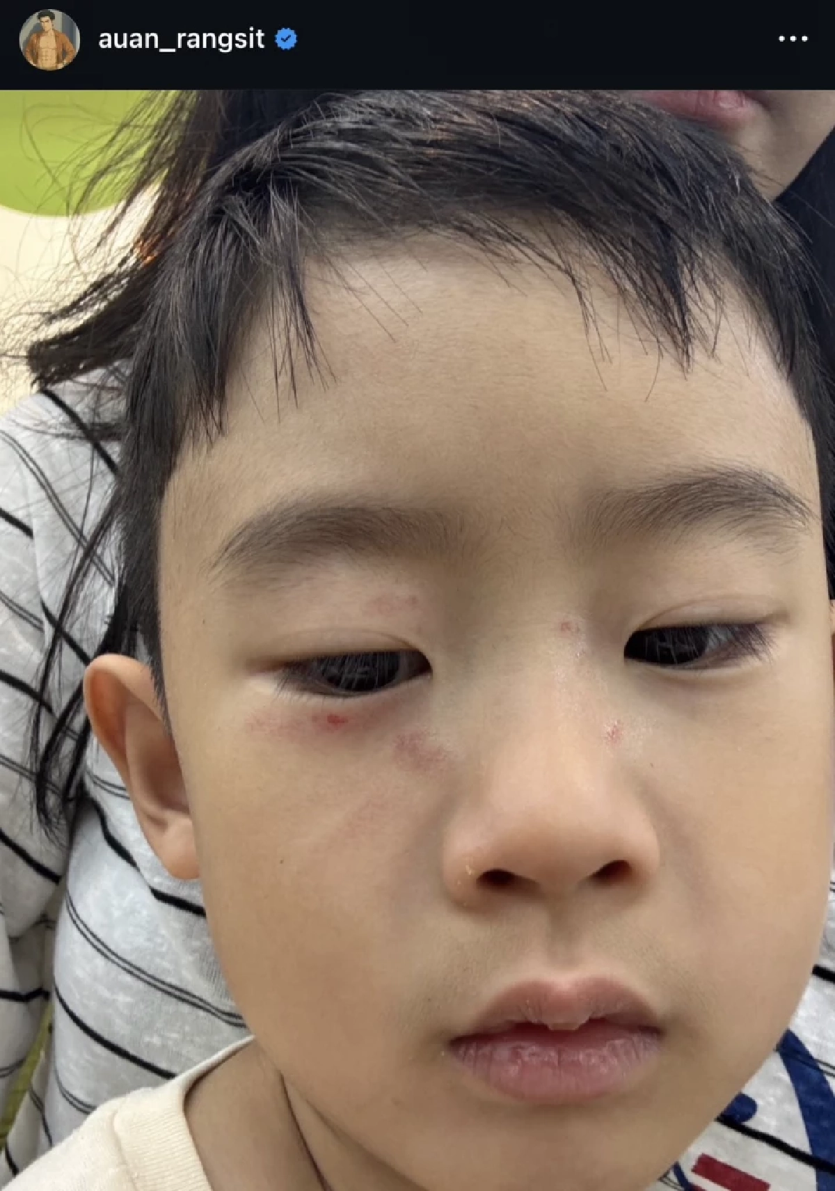 "อ้วน รังสิต" เดือด! "น้องโรฮา" ลูกชาย เจอ "เด็กจิตไม่ปกติ" เดินมาข่วนหน้า