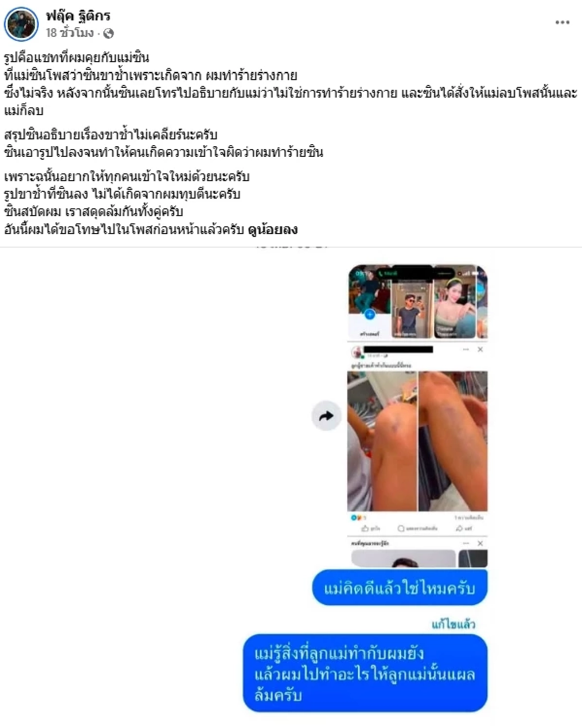 "ฟลุ๊ค ฐิติกร" เดือดอีก! คลิปวงจรปิด แฉแรง "แม่ยาย" เรียกสินสอดโหด ตอนอายุ 19