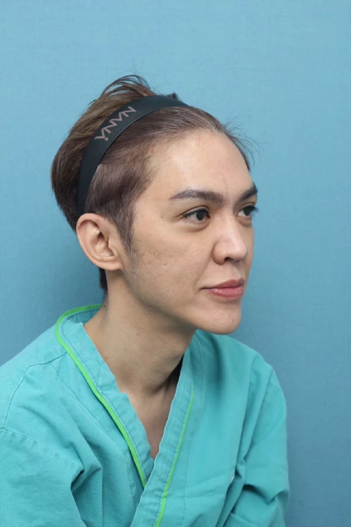 "ดัง พันกร" เผยหน้าเวอร์ชั่นล่าสุด เปิดใจหลังทำศัลยกรรมชุดใหญ่