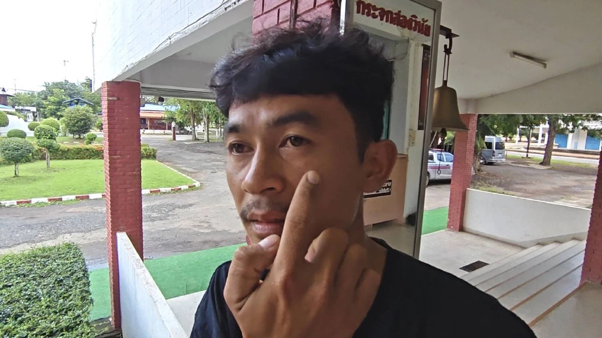 หนุ่ม 31 โดนต่อยเบ้าหน้า เหตุผลสุดพีค "xึงหล่อกว่าxูได้จั่งใด๋?!"