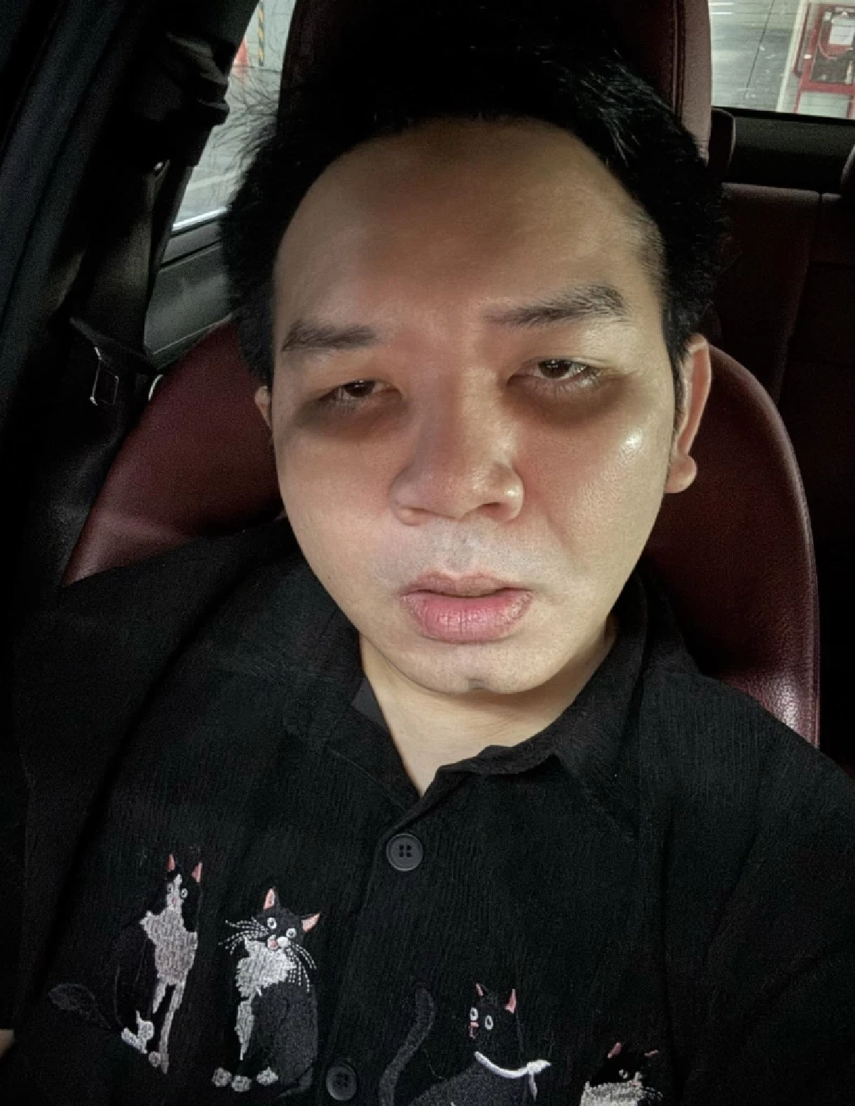 "หมอแล็บแพนด้า" อธิบายชัดสารต้องห้าม "ฟูโรซีไมด์" คืออะไร?