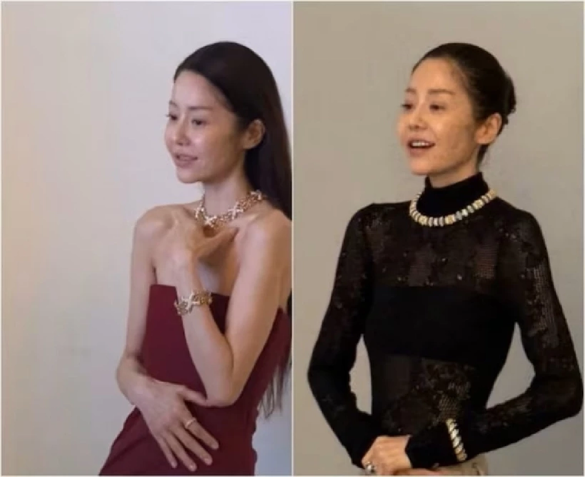 ความจริง 'นางเอกดัง ก.' ซูบผอมเหลือแต่กระดูกโผล่งานปารีสเดินเซ