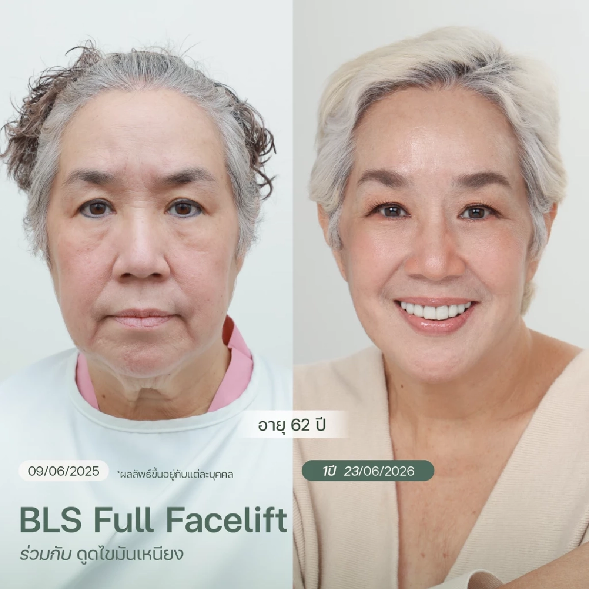 ถอดรหัสความสำเร็จ BLS Surgery Center คว้ารางวัล 2 ปีซ้อน