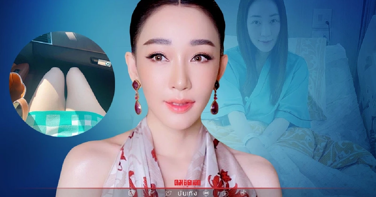 "ตู่ ปิยวดี" เผยภาพขาขวาลีบ หลังผ่าตัดหัวเข่า