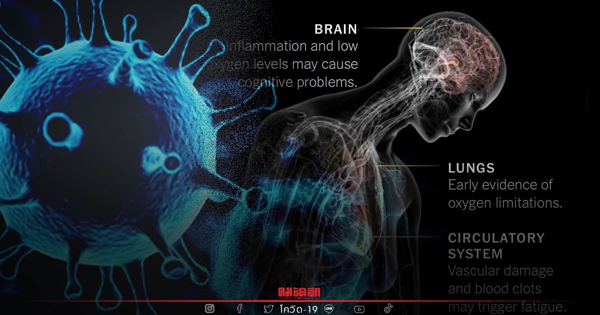 "Long COVID" กระทบกับอวัยวะหลายส่วน แถมเกิดโรคใหม่หลังติดโควิดเพียบ "Long COVID" กระทบกับอวัยวะหลายส่วน แถมเกิดโรคใหม่หลังติดโควิดเพียบ
