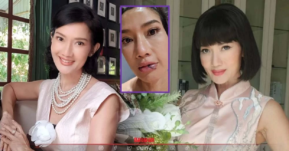 นักแสดงรุ่นใหญ่ "ดี้ ชนานา" ประสบอุบัติเหตุ รถไถลชนเสาไฟฟ้า ต้องเย็บด่วน