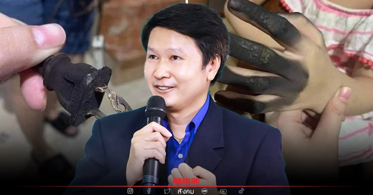 พ่อแม่ระวัง "ไฟช็อต" เด็กเล็ก เสียบปลั๊กเอง มือไหม้เกรียม เกิดขึ้นได้จริง พ่อแม่ระวัง "ไฟช็อต" เด็กเล็ก เสียบปลั๊กเอง มือไหม้เกรียม เกิดขึ้นได้จริง