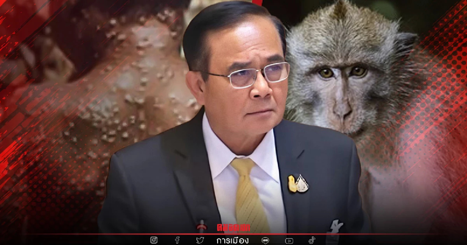 "นายกรัฐมนตรี" กำชับหน่วยงาน เข้มงวดป้องกัน "ฝีดาษลิง"