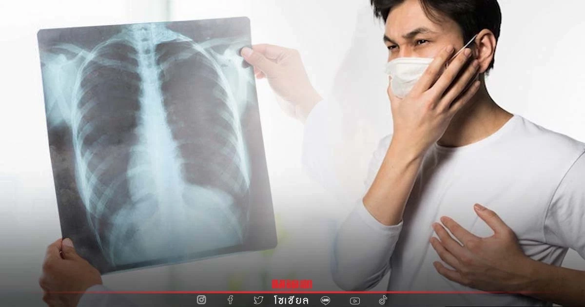 ทบทวน-เร่งรัดคุม "วัณโรค" ยึด 5 ยุทธศาสตร์มุ่งเป้าลดอัตราป่วย