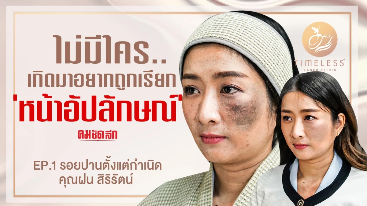ไม่มีใครเกิดมาอยากถูกเรียกว่า 'หน้าอัปลักษณ์' ไม่มีใครเกิดมาอยากถูกเรียกว่า 'หน้าอัปลักษณ์'