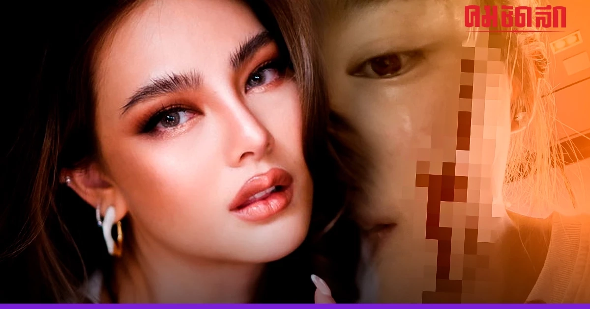 'ดิว อริสรา' ตอนปี 2562 เกิดอุบัติเหตุ เย็บ 39 เข็ม หวิดเสียโฉม 'ดิว อริสรา' ตอนปี 2562 เกิดอุบัติเหตุ เย็บ 39 เข็ม หวิดเสียโฉม