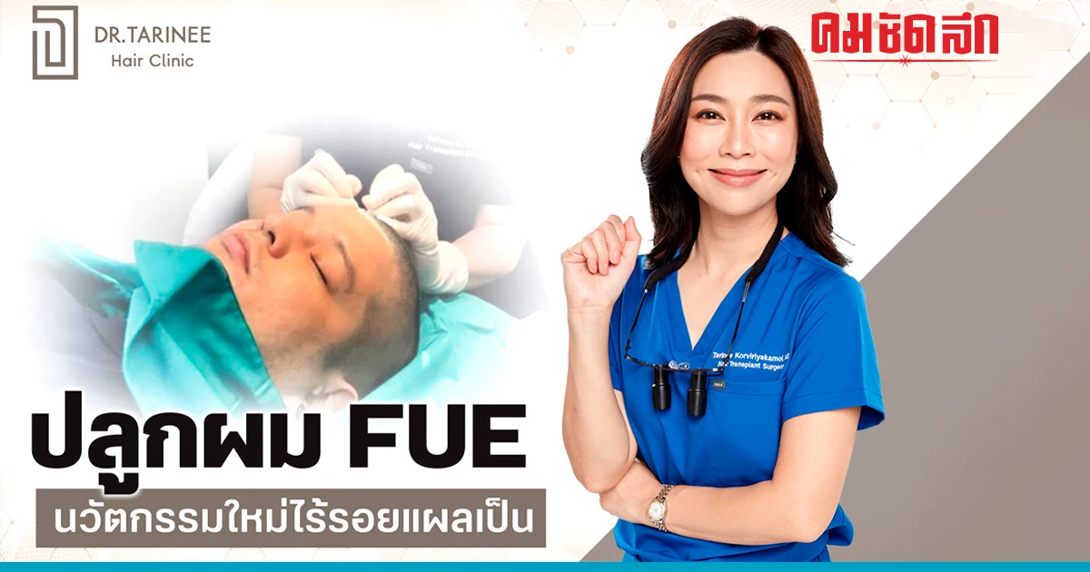 ปลูกผม FUE นวัตกรรมใหม่แห่งการปลูกผมถาวร