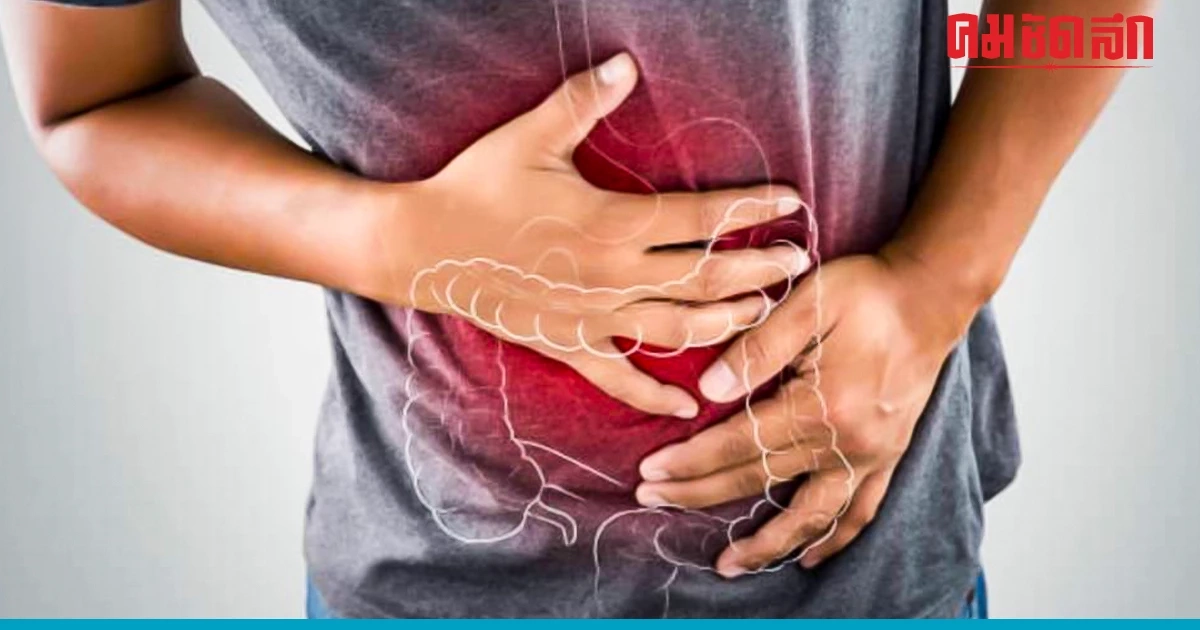 5 โรคทางเดินอาหาร มาแบบเงียบๆ แต่นำไปสู่โรคร้ายแรง