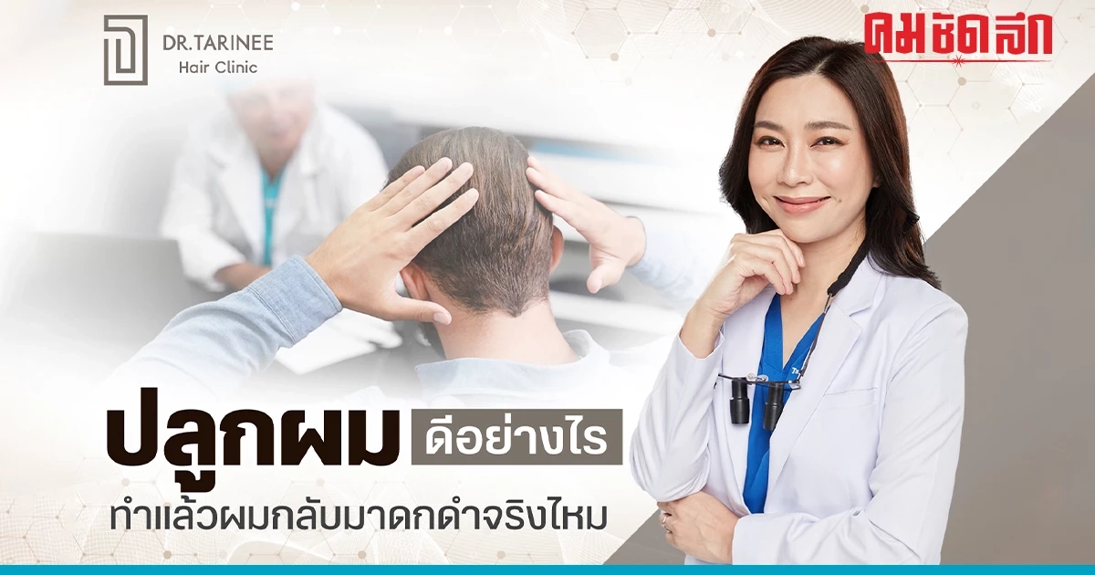 ปลูกผมดีอย่างไร ทำแล้วผมกลับมาดกดำจริงไหม ปลูกผมดีอย่างไร ทำแล้วผมกลับมาดกดำจริงไหม