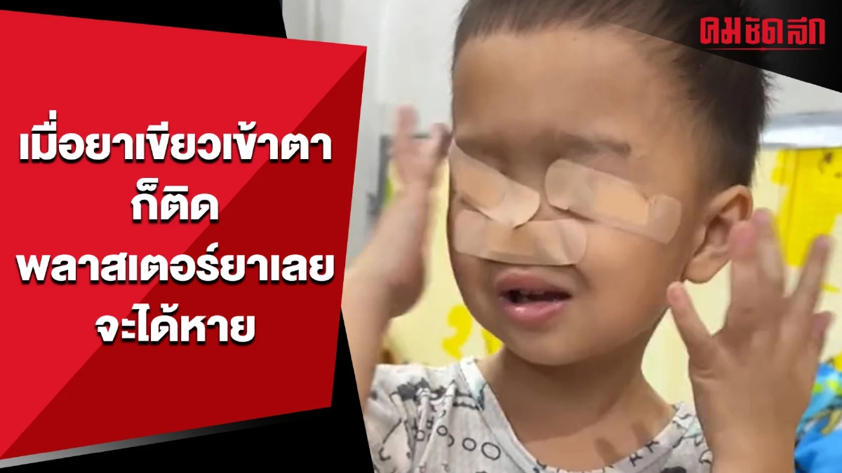 เมื่อยาเขียวเข้าตา ก็ติดพลาสเตอร์ยาเลยจะได้หาย (มีคลิป)