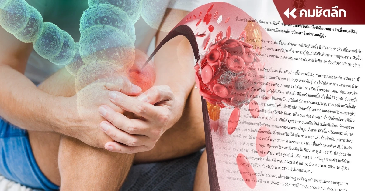 แจงข้อเท็จจริง 'โรคแบคทีเรียกินเนื้อ' ใครมีอาการตามนี้ พบแพทย์ด่วน